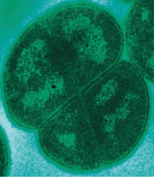 A candid photo of Deinococcus radiodurans (aka Conan the Bacterium) (Photo credit: Michael Daly, Uniformed Services University)